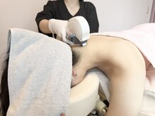 サエラ(SAERA)の雰囲気（うなじや眉毛の脱毛も人気です！！）