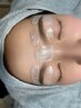 〈WAX脱毛〉鎮静パック付き　顔＋眉毛　11000円→8000円