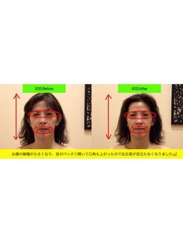 アジール 新潟市(agir)/Before/After 