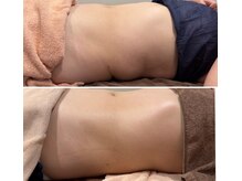 ディアウーマン(Dear Woman)の雰囲気（【レモンボトル】頑固ぜい肉を撃退！後戻りさせないダイエットに）