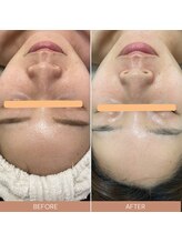 ルルーディア(LOULOUDIA)/くすみのないクリアな素肌へ♪