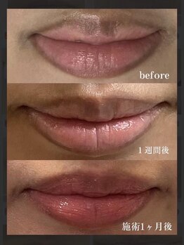 ファースト(1st)/ローマピンク【唇・リップ】