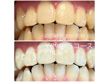 ホワイトニングルーム 川崎店(WhiteningRoom)/ホワイトニング/川崎