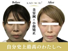 カドモリ 心斎橋(KADOMORI)