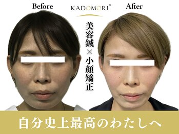 カドモリ 心斎橋(KADOMORI)