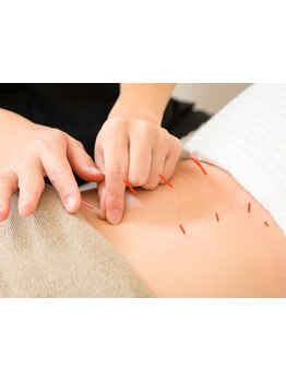 鍼灸施術を受けたい