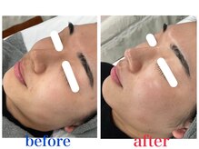 フルオール(FRUOR)の雰囲気（ビオフィートでデトックス！毛穴＆内的要因によるトラブル改善！）