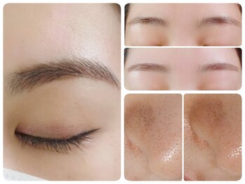 トータルビューティ ノイド(Noid)/いちご鼻撃退+美眉毛WAX脱毛