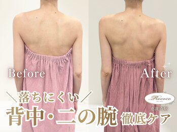 ロココ 恵比寿店(Rococo)の写真/【夏に差がつく】二の腕・ハミ肉をバストへ！姿勢から整える本格サイズアップで、後ろ姿まで美しいラインへ