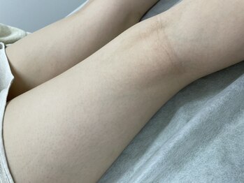 ナノハナ/鹿沼市全身脱毛美容室ナノハナ