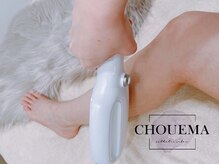 シュエマ(CHOUEMA)/［往復しない最新スピード脱毛］