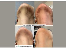 ビエン(美艶 b.en)/長引く肌トラブルにはWケア