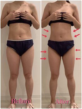 スペチアーレ 夙川/顔とボディのお悩みが解決できる