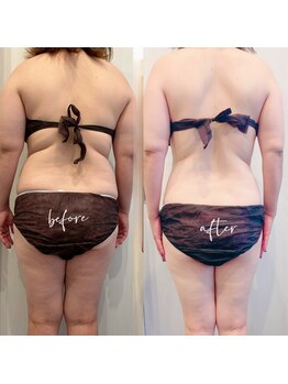 ルシェリアノーブル(le cherien noble)/