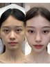【二重あご&むくみ】微電流小顔リンパ＋ヘッド＋首肩こり+デコルテ 70分¥5600