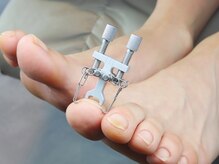 フットケア クラッシー(footcare classy)