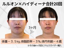 ヨサパーク ハナ(YOSA PARK hana)/