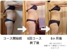 エルバード