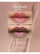 オアシス 吉祥寺店(Oasis)/メラニンケアLEMELLAルメラ
