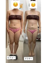 メリアミーゴ(Meli amigo)/