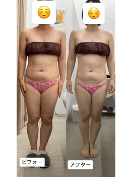 メリアミーゴ(Meli amigo)/