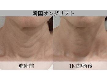 スキンスタジオ レア(Lea)/