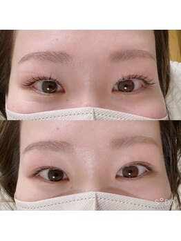 ジェルメ(Germer)/まつげパーマBefore→After