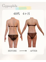 ジプソフィラ(Gypsophila)/痩身ビフォーアフター