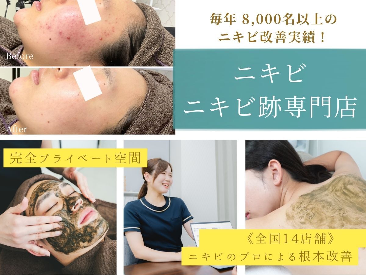 ニキビケア研究所 高崎店｜ホットペッパービューティー