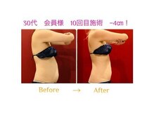 ルミーナ 高崎本店(Lumina)の雰囲気（ぽっこりお腹スッキリ本格痩身）