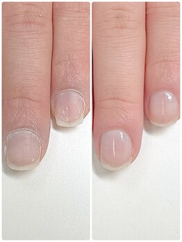 ルクレール カシェット(Le clair cachette)/美爪育成3ヶ月コース