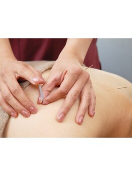 鍼灸施術を受けたい