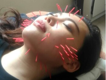 泉町鍼灸整骨院の写真/熟練の手技と鍼灸の組み合わせで溜まった疲労を徹底的に解消♪美容鍼+マッサージ+ヘッドスパがオススメ◎