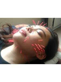 疲れを解消したい