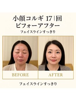 ケイビューティ(k-beauty)/小顔コルギ/インディバ/痩身