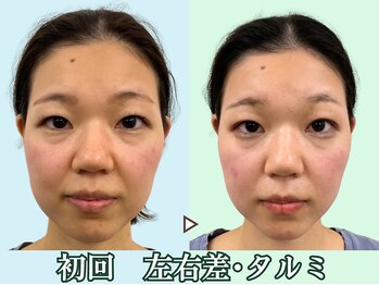 ナチュラルビューティーフェイス 横浜(NBF)/顔の印象を変えてしまう歪み