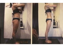 パーフェクトボディプレミアム 札幌駅前店(PERFECT BODY PREMIUM)/お客様　ビフォーアフター（32）