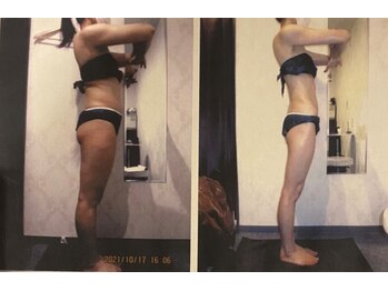 パーフェクトボディプレミアム 札幌駅前店(PERFECT BODY PREMIUM)/お客様　ビフォーアフター（32）