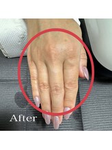 ナネア(Nanea)/スペシャルハンドパック