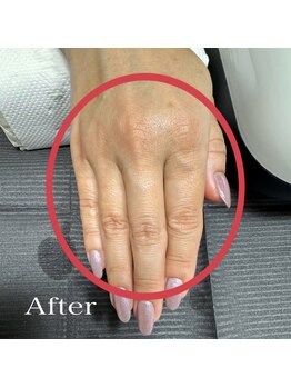 スペシャルハンドパック