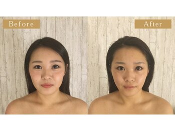 グレースフィオーレ 那覇店(gracefiore)/☆ビフォーアフター８☆