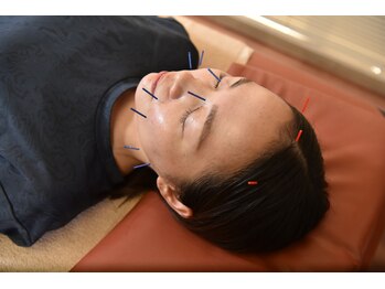 東洋はり灸院 大津石山院/東洋医学×美容鍼