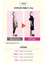 豊中吹田美容整体リジョイス/リジョイスダイエット整体◇実例