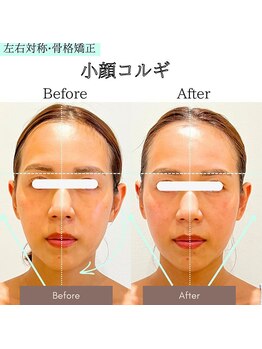 ジーンバイピエル 中野店(gene by PIEL)/左右対称小顔コルギ×#LDM