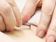 かなざわ鍼灸院/