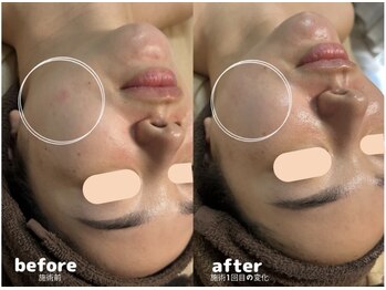 セルヴィノバ(CELL VI NOVA)/揺らぎやすい季節におすすめ