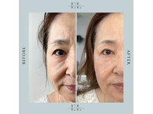 アグラン ヴィラ スイタ(a Gland villa SUITA)の雰囲気(お悩みがあるほど効果を実感!今からでも遅くないです)