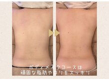 スーズ(Soothe)の雰囲気（４種のマシンがガチガチなコリや脂肪を柔らかくスッキリします♪）