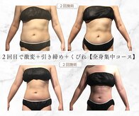 サンテボーテ(Sante Beaute)