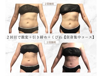 サンテボーテ(Sante Beaute)の写真